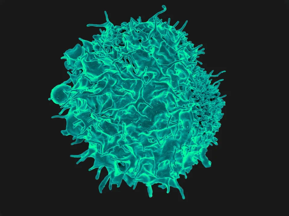 Un linfocito T visto al microscopio electrónico